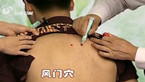 感冒按摩什么穴位